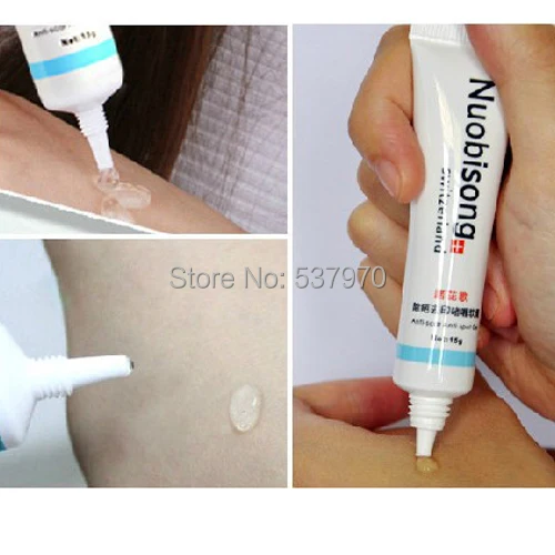 Nuobisong 15ml Facial Treatment Cream To Treat Acne Scars Scald Striae Of Pregnancy Face Care Stretch Marks Free Shipping | Красота и