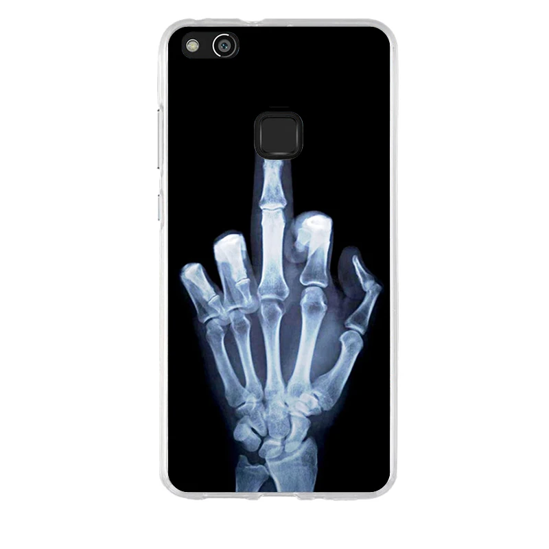 Чехол для Huawei P10 Lite чехол с 3D рисунком силиконовый huawei lite мягкий TPU P10lite 5 2 &quot сумка