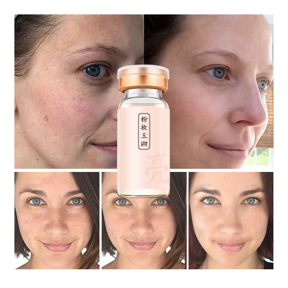 SOON PURE Выпариваемый раствор L VC 4PCS|face care serum|beauty serumbeauty |