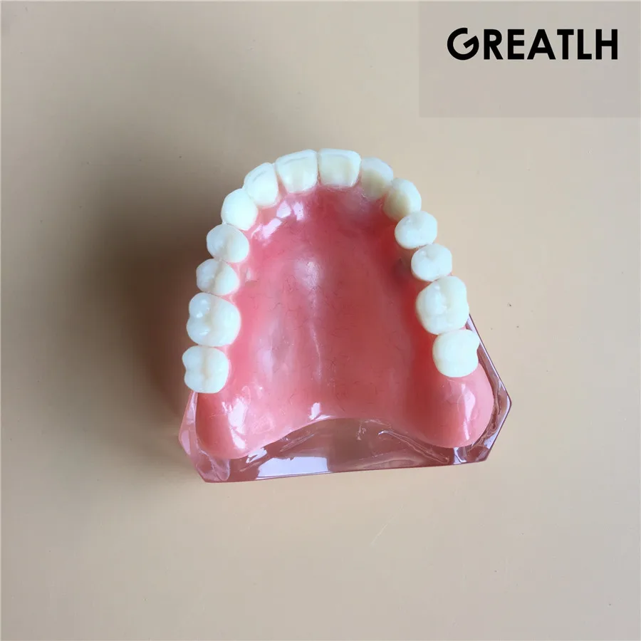 Модель зубного имплантата зубные зубы модель|dental tooth|teeth modeltooth teeth |