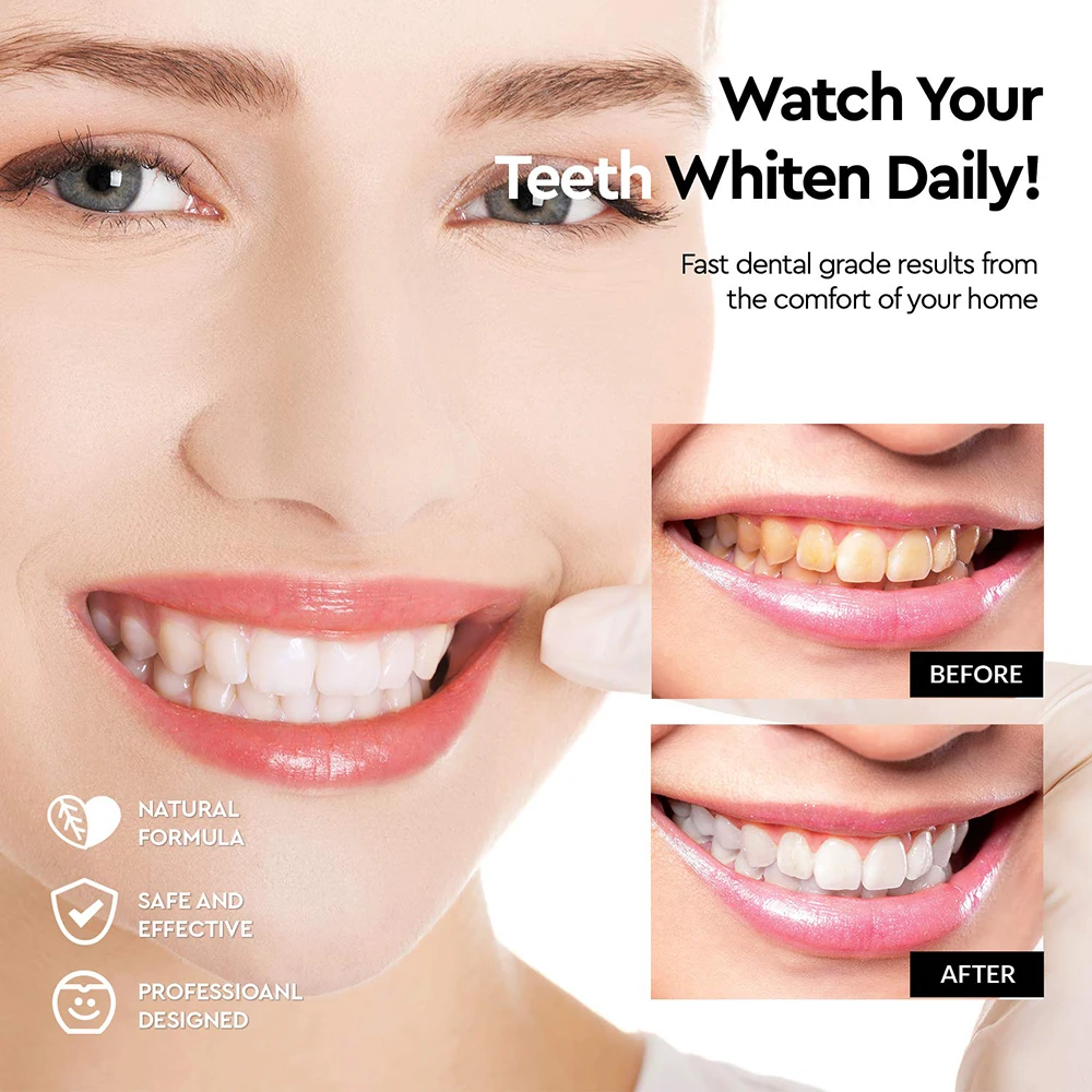 

Tongwode 1 Rotaring Teeth Whitening Gel Pen DIY Home Dentist for Instant Cleaning Tooth Stains Oral Hygiene