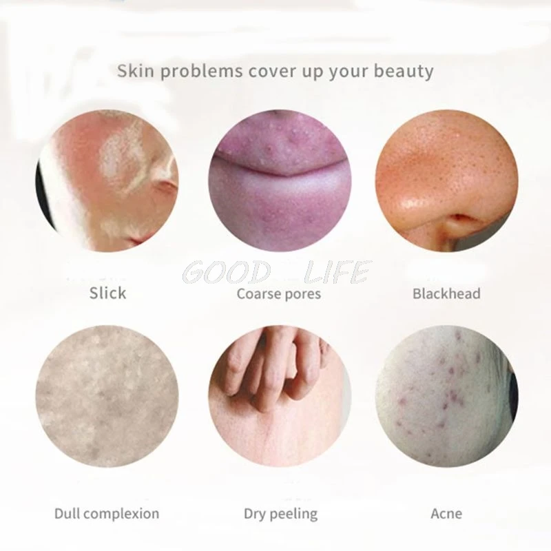 

100g Handmade Bamboo Charcoal Soap Deep Face Cleansing Skin Whitening Blackhead Remover Oil Control Acne Treatment Shrink Pores