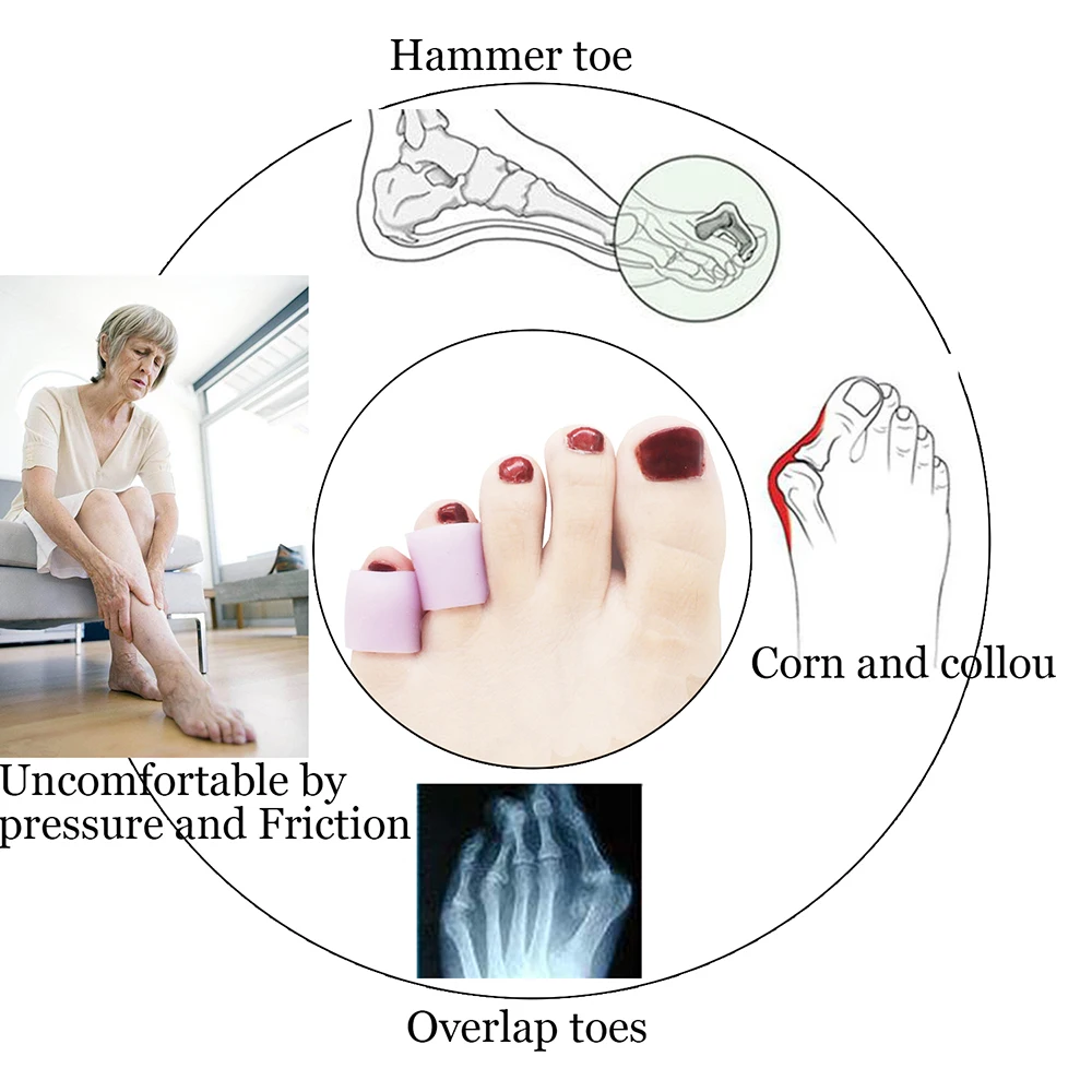 20 шт. силиконовая гелевая защитная трубка для пальцев рукава-разделители трещины