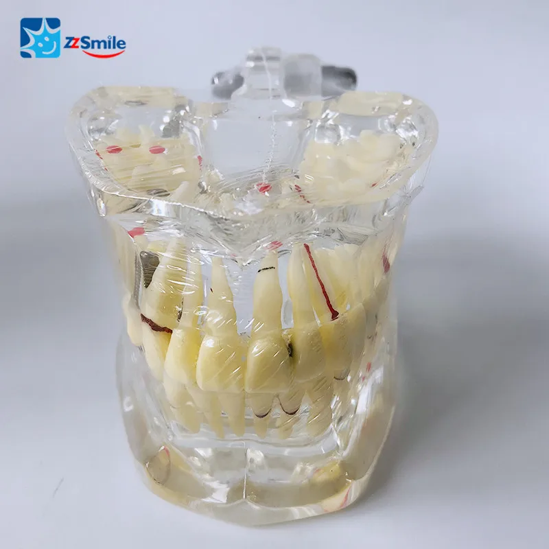 Модель M4001 для взрослых с патологиями/модель стоматологических