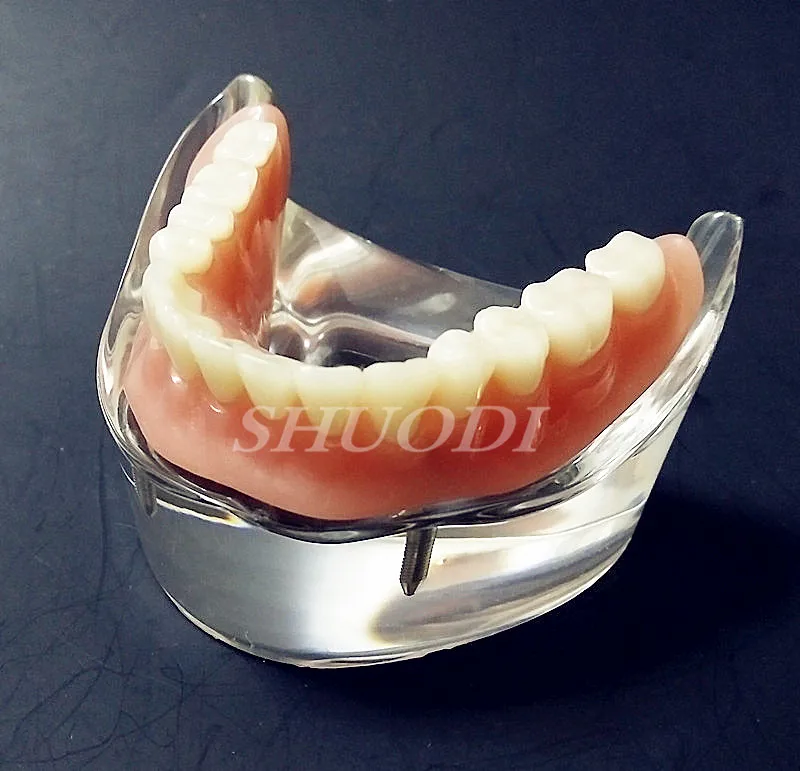 Декоративная Стоматологическая верхзубная нить внутренняя мандибулярная