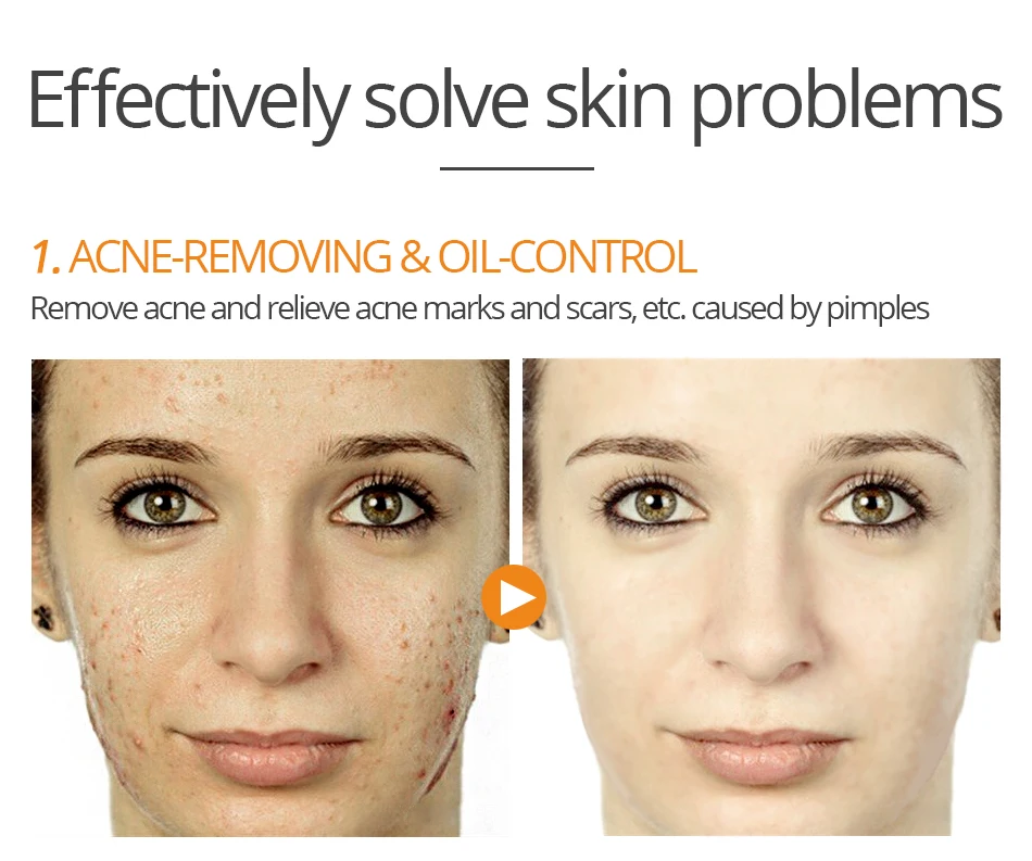 VIBRANT GLAMOUR Salicylic Acid Condensation Cream удалить маска для лица против прыщей масло управление уход за кожей лечение пигментации корректор 100 г