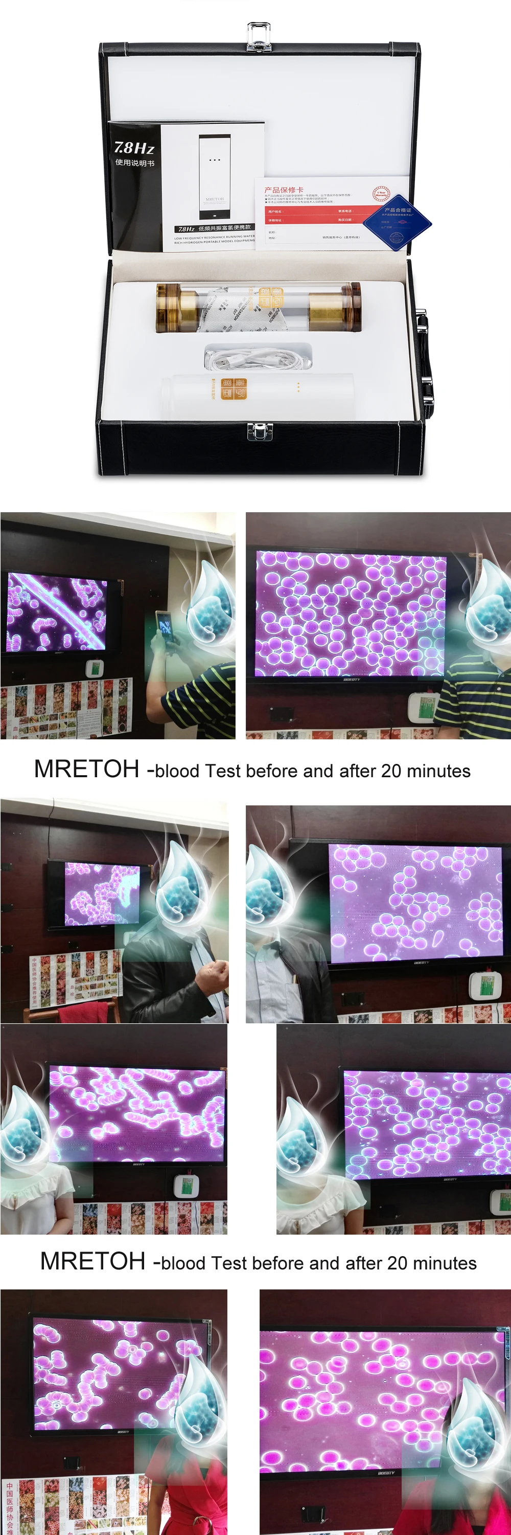 Япония SPE H2 богатая водородом чашка воды и молекулярный резонансный эффект технология MRETOH антивозрастной лечение хронических заболеваний