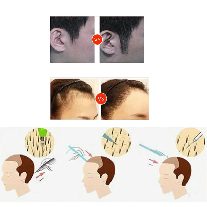 

FUE Hair Follicle Extractor Scarless Hairless Treatment Implanted Hair Planting Hair Eyebrow Makeup Tools