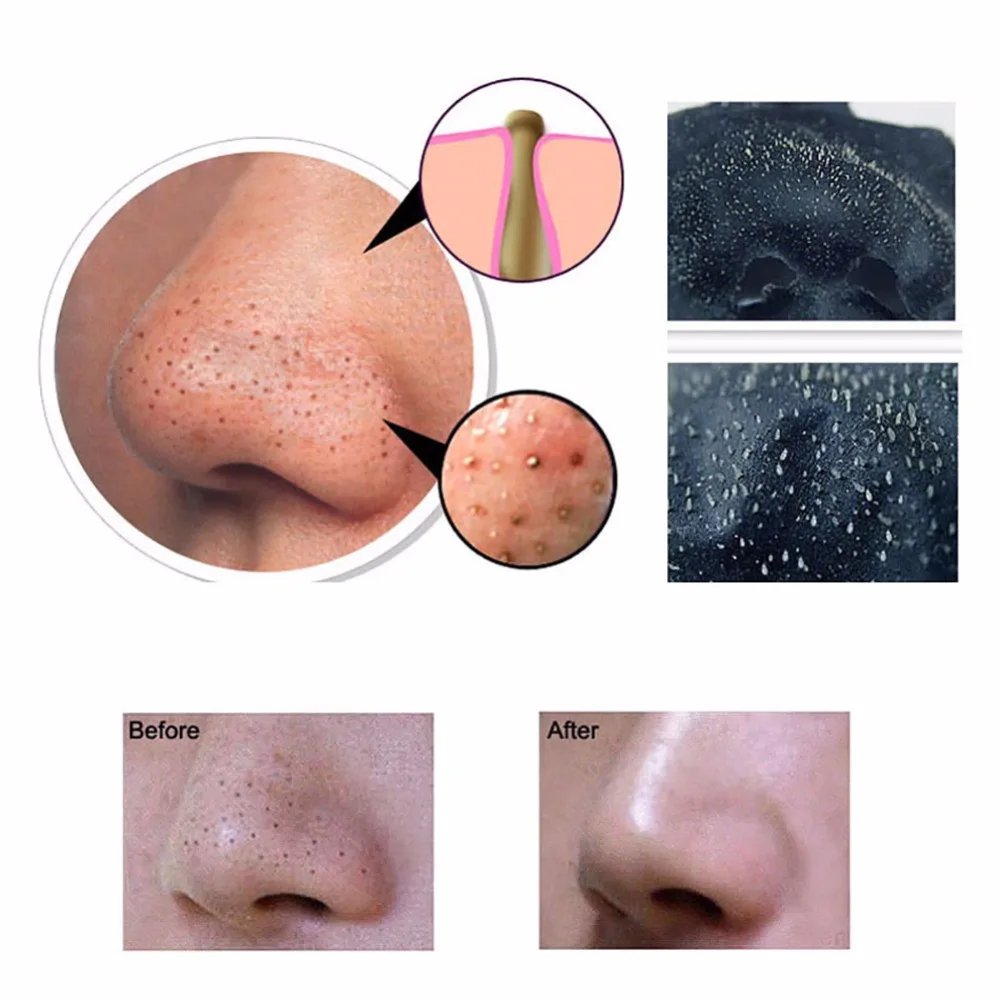 2017 Для Удаления Угрей Уголь Очищающая Маска Черный отрывной Лица Очищающий |