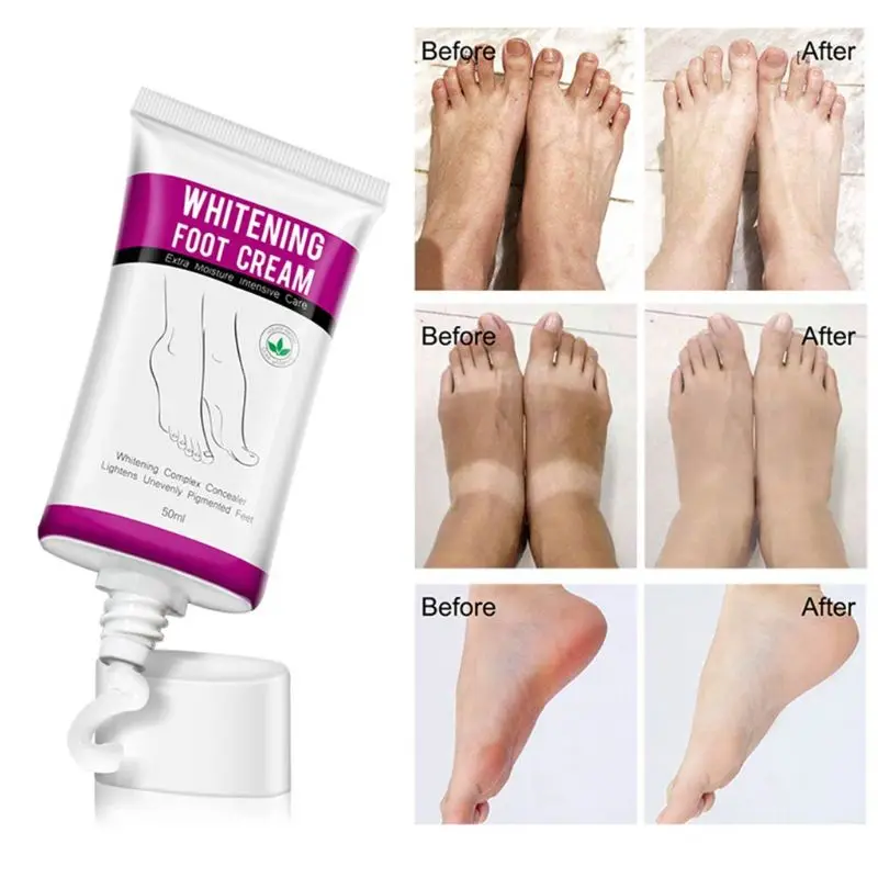 

new 50ml Whitening Foot Cream Moisturizing Treatment Hydrating Nourishing Lightens Unevenly Pigmented Feet Care Lotion