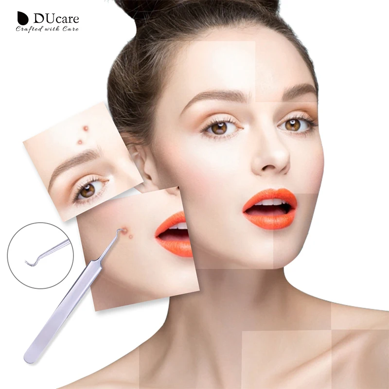 DUcare 3 шт. Черноголовых Пинцет порока удаления точки изгиб головы комедона акне