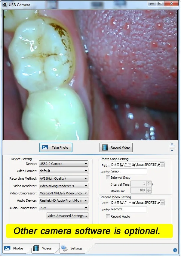 AwadaTech зубные полость рта USB-камера стоматолог аксессуары отбеливание зубов 6