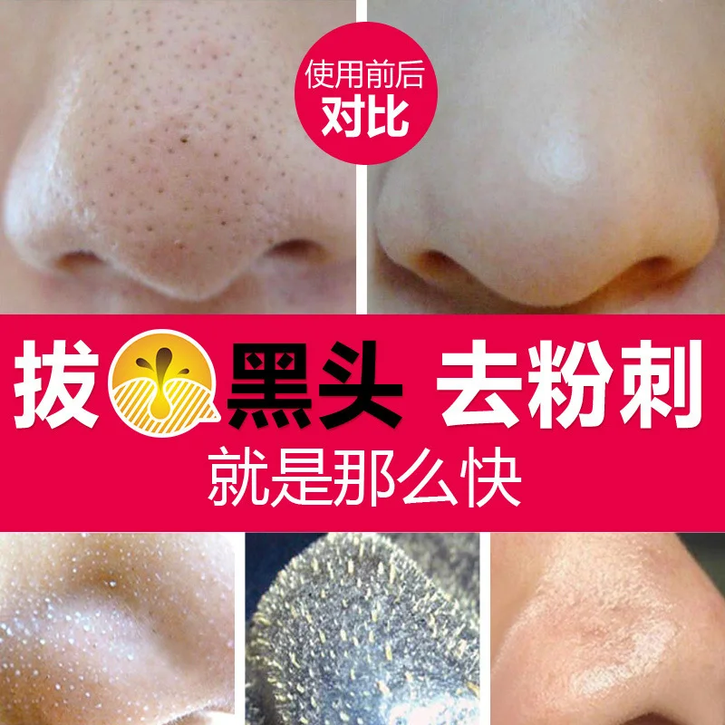 3 шт. маска для удаления черных точек на лице | Красота и здоровье