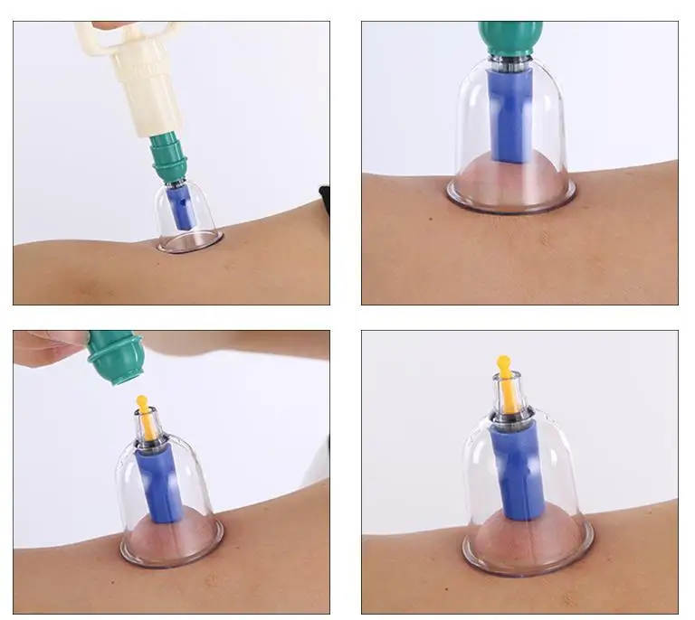 Вакуумное устройство для остановки 24 банок бытовой магнитотерапии с толстыми
