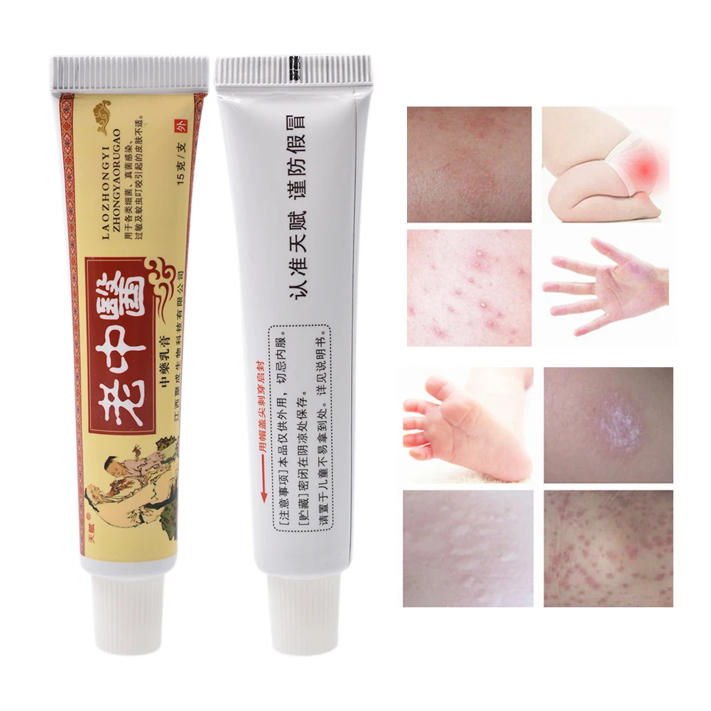 Антибактериальный и противовоспалительный бальзам LaoZhongYi Cream15g для снятия зуда от