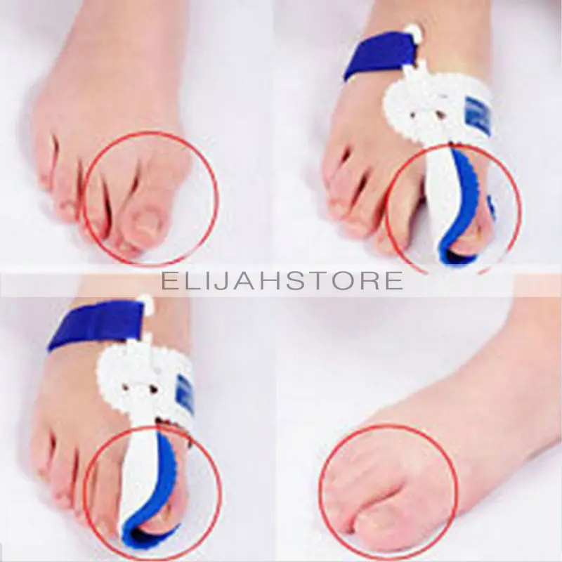 1 пара корректор большого пальца ноги облегчение боли вальгусная деформация уход