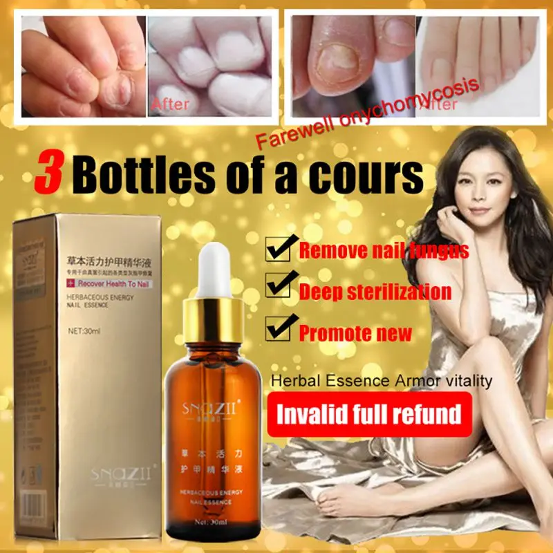 Горячая 30 мл гель для ухода за ногтями грибковое Лечение ногтей эссенция
