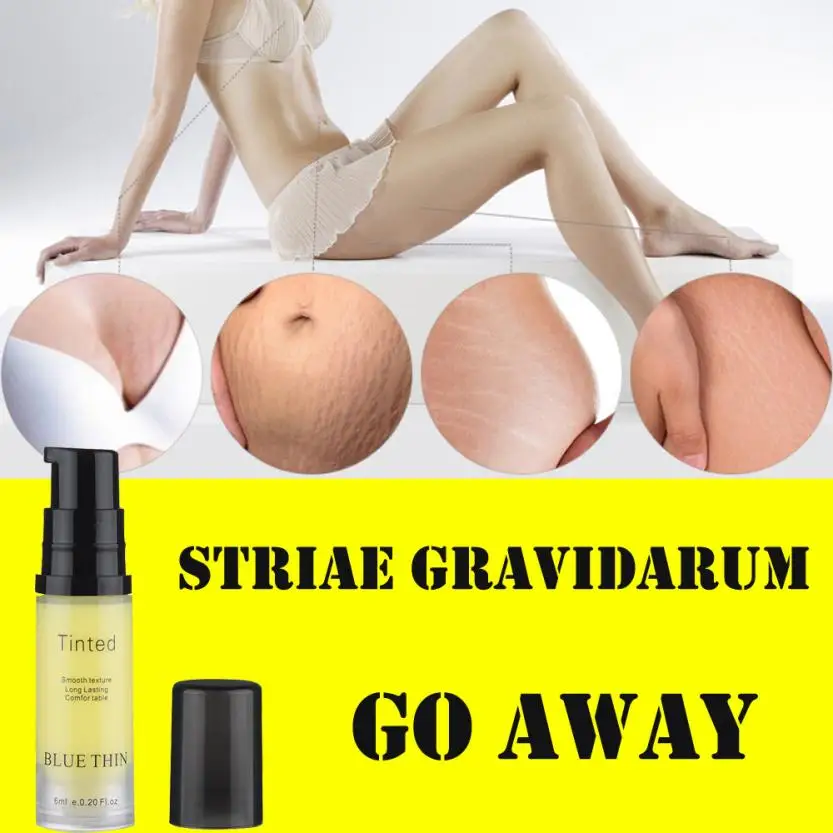 Striae Repair крем для удаления рубцов от акне, крем от растяжек, жирный шрам, лечение гравитарума, 6 мл, дропшиппинг, 18aug15