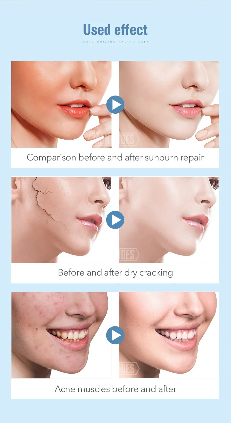 1pcs Baby Skin Moisturizing Facial Mask Silk Ice Soothes Skin Shrink Pores Face Mask Whitening Brighten Masks Face Care