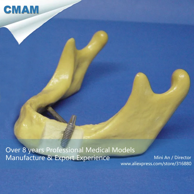 

12613 / Toothless Mandible Jaw Model Implant Practice Training, Medical Teaching Anatomical Models