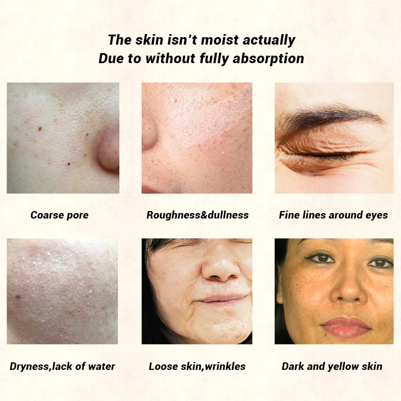 Сыворотка для лица OMYLADY колготки против морщин старения инъекция коллагена