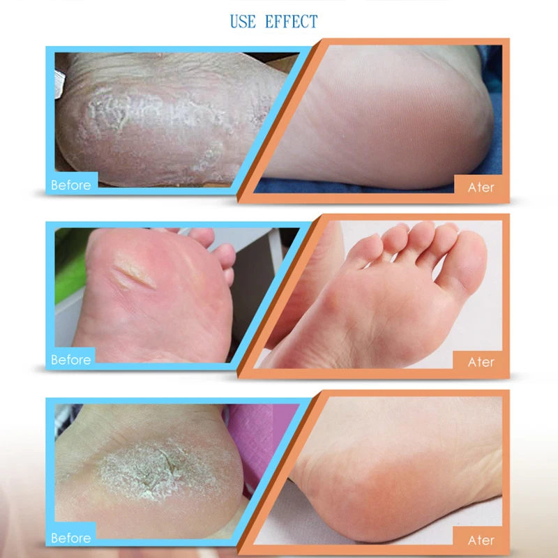 JINDING Электрический инструмент для ухода за ногами педикюрный аппарат жесткая