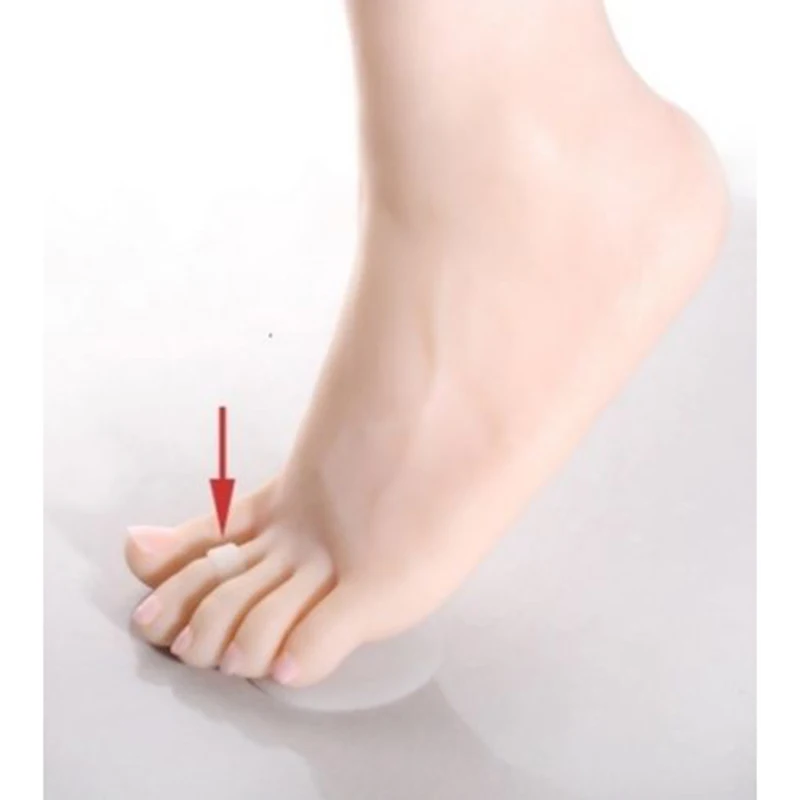 Уход за ногами Чистый гель плюсневая подкладка больные мячи Подушечка для ног