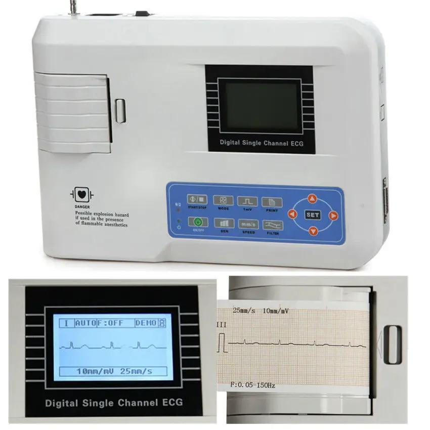 contec ecg100g single channel elektrokardiograph ekg machine monitor cable portable printer free global shipping