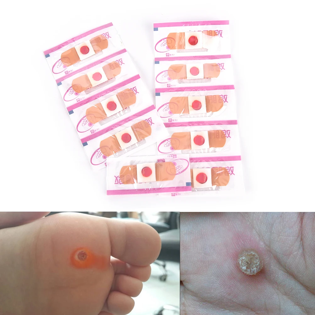 10 шт. удаление кукурузы для рук омертвевшей кожи Pedi Cure Care Китайская традиционная