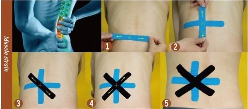 Кинезио тейпами(Kinesio tape) улучшает кровообращения и лимфотока 2074