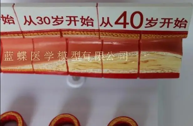 Модель анатомии сосудов человека сосудистая модель артериализация