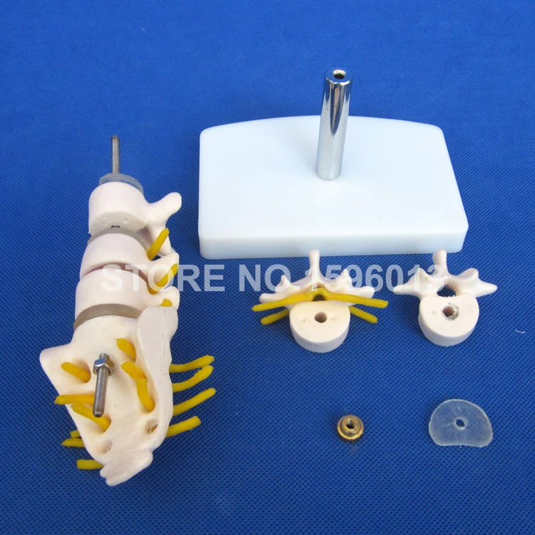 Мини поясничная модель позвонка с крестиком коциксом и грыжевым диском поясным