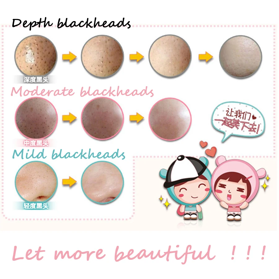1 шт. Pig Nose маска для удаления угрей инструмент прыщей Clear Black Head 3 шага Красота