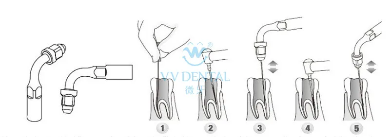 Стоматологический Скейлер Endodontics Kit SEKS Серебряный Стоматологический материал из нержавеющей стали стоматологическое оборудование для DTE продуктов odontology