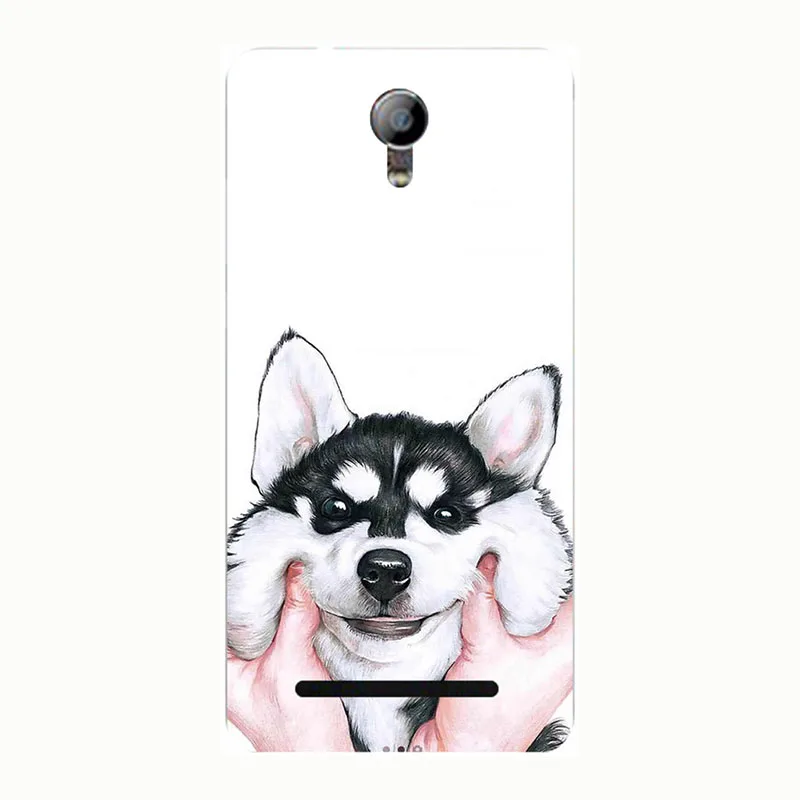 Ultra Slim HD Painted Soft Silicon Case for Doogee X3 X5 X6 X7 X9 X10 Mini Max Pro Back Cover Original Fundas Cartoon Coque Capa |