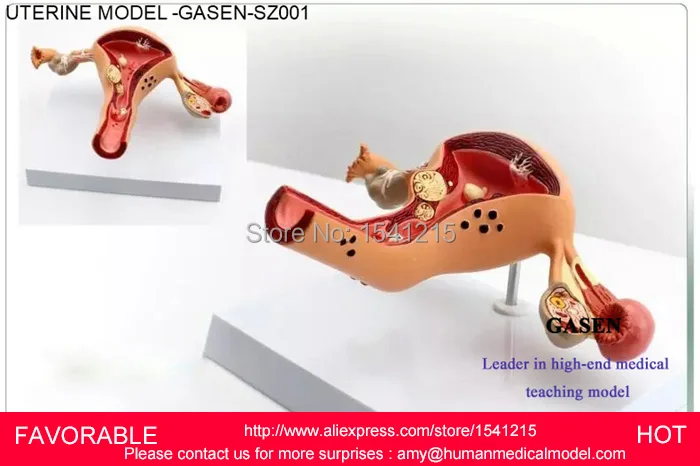 Женская репродуктивная система утробная яичная Вагина Отдел репродуктивной