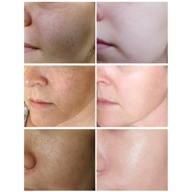 40 мл витамин C Жидкая Сыворотка увлажняющая укрепляющая отбеливающая эссенция