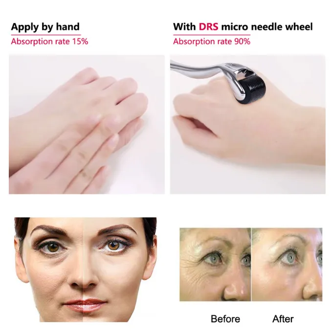DRS 540 derma roller micro титановые иглы mezoroller аппарат для ухода за кожей и лечения