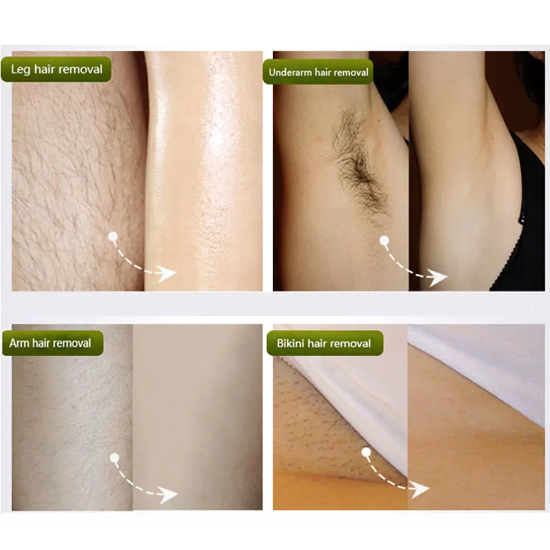 Крем для удаления волос DR RASHEL Алоэ Вера Витамин Е Ноги подмышек бикини линия крем