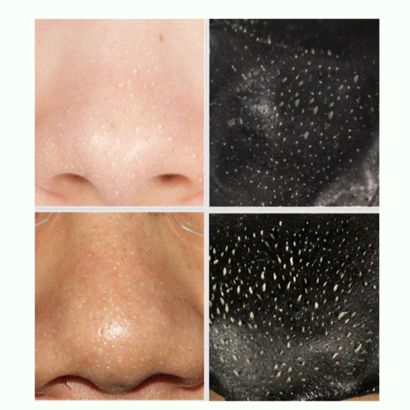 DR. RASHEL всасывающая черная маска для удаления черных точек носа отшелушивающая