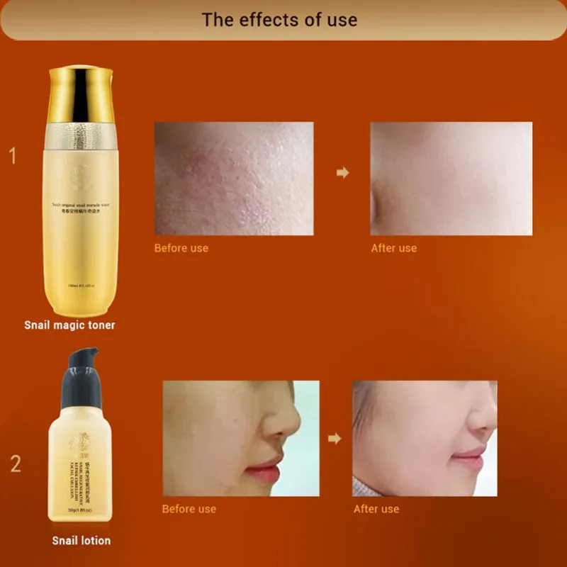 Qyanf улитка отбеливающая крем ухода за кожей лица лечение уменьшить шрамы прыщи