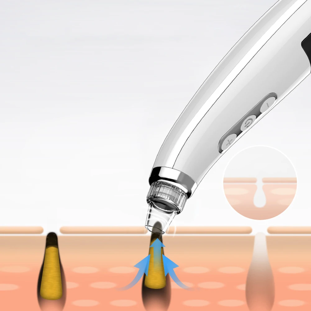 USB Перезаряжаемый экстрактор для удаления угрей Очищение лица акне светодиодный