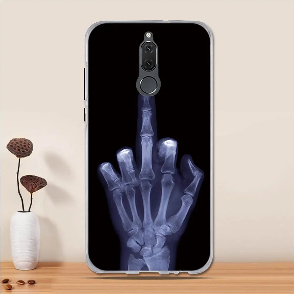 19 Чехол для телефона huawei mate 10 Lite, чехол, силиконовый 3d Мягкий ТПУ чехол для huawei Nova 2i, чехол для huawei Honor 9i - Цвет: 19