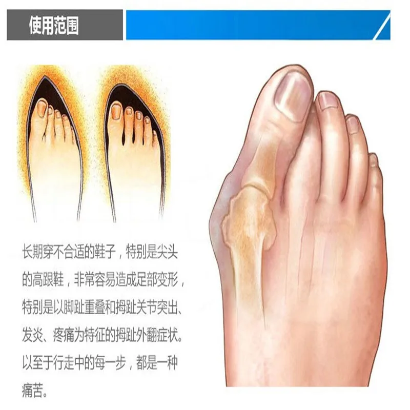 Детали 2 силиконовые разделители для пальцев ног ортопедическая коррекция