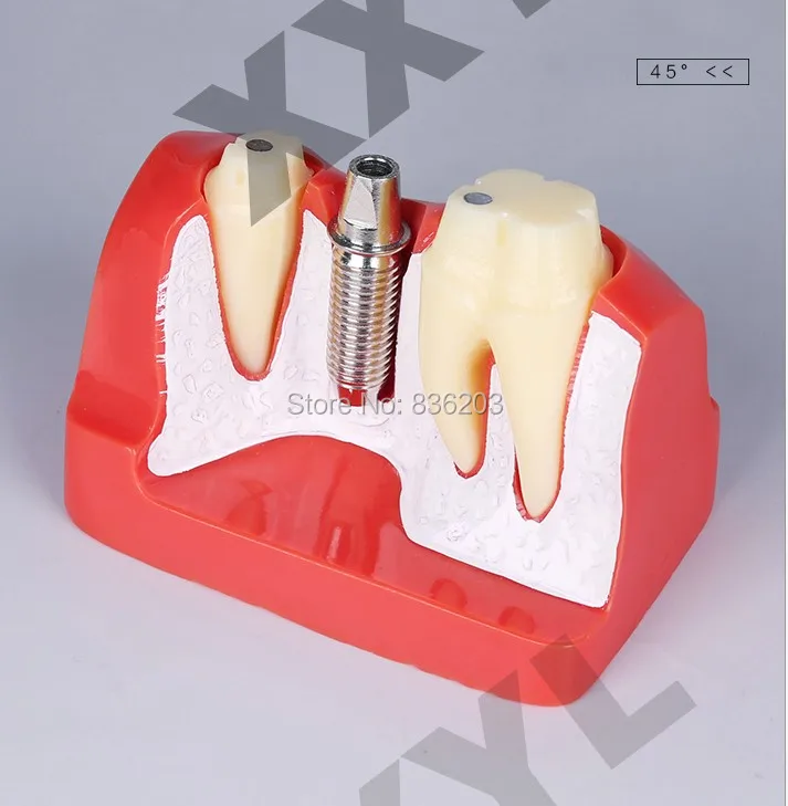 Стоматологическое лабораторное оборудование отбеливание зубов гигиена полости