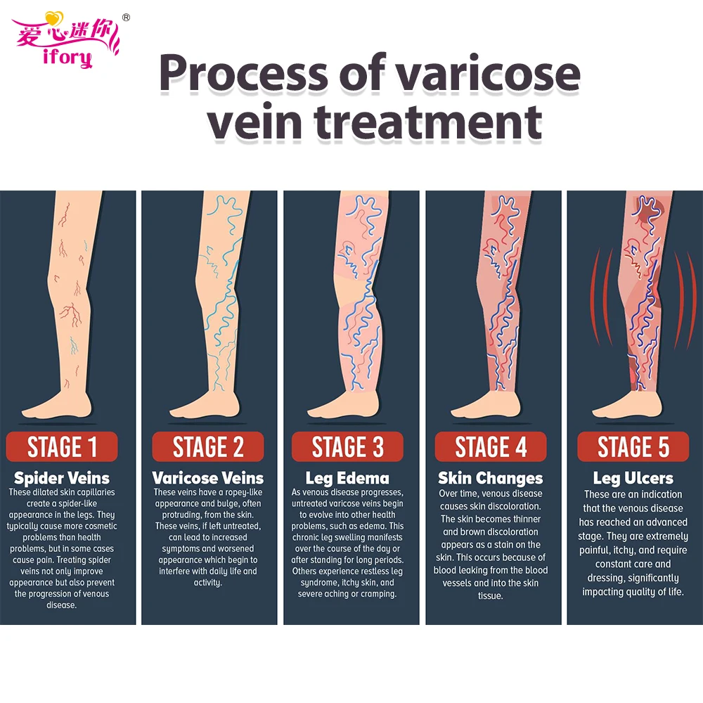 Китайский пластырь Ifory 10Boxs натуральный травяной крем для лечения варикозного