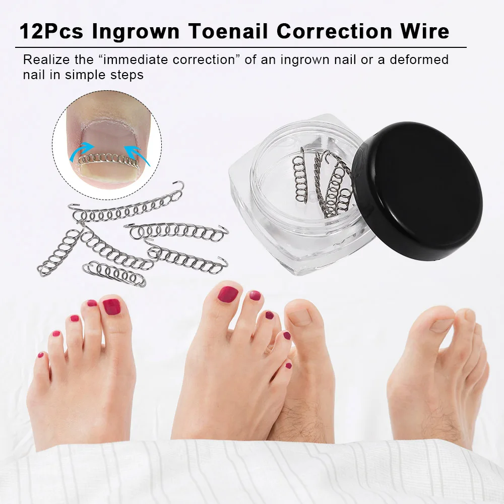 12 шт. фиксатор для педикюра коррекция вросших ногтей|pedicure tools|foot care pedicurefoot |