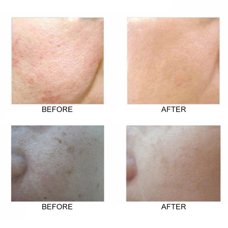 Двусторонняя силиконовая щётка для очищения лица портативный размер 3D очистки