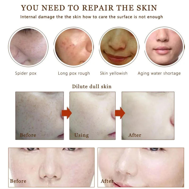 

Hot Sell Natural Vitamin C Serum Freckle Remove Dark Blots Disappear Ageless Facial Skin Care Cleansing Essence