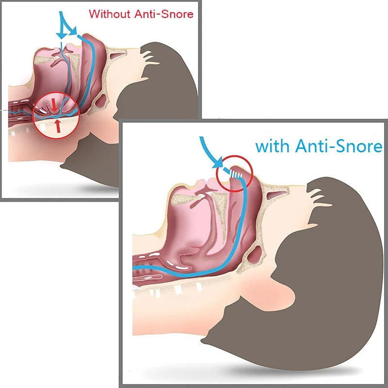 Снятие храпа устройство для дыхания носом стоп храп устройства носа против клип